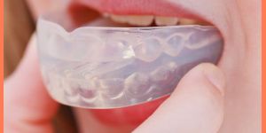 Mouth Guard