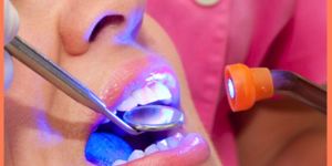 Re Root Canal Treatment with Laser