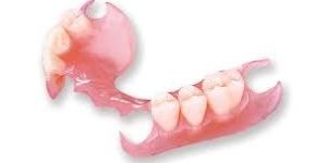 Flexible Partial Denture