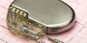 Heart Pacemaker