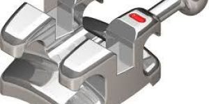 Orthodontics Brackets