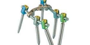 Pedicle Screw