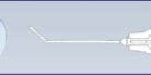 Nucleus Hydrodissector