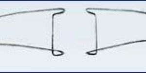 Wire Lid Retractor