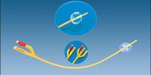Foley Balloon Catheter