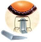 Microsurgical Knives