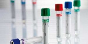 Blood Collection Tubes