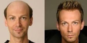 Hair Weaving Service