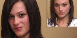 Non-Surgical hair bonding service