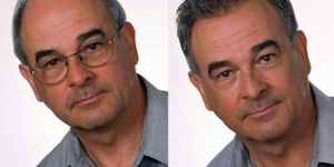 Non Surgical Hair Replacement