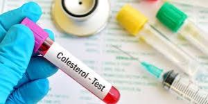 Cholesterol Profile