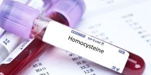 Homocysteine