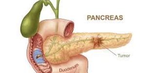 Pancreas Profile