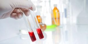 Chemical Synthesis Services