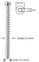 Small Cannulated Cancellous Screws, 4.0mm Dia, Full Thread