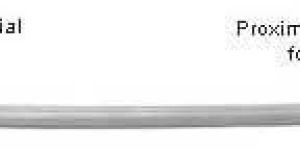 XL Universal Unreamed Femoral Nails