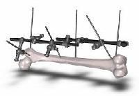 Orthopedic External Fixators