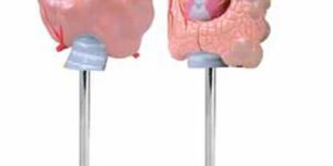 Thyroid Diseases Model