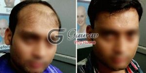 Hair Bonding Treatment