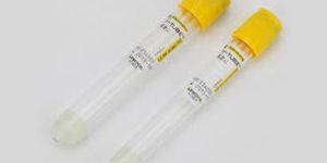 Serum Separating Tubes