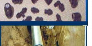 Pipes & Pipe Fittings