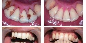 Scaling Dental Services