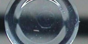 Orthokeratology Contact Lenses