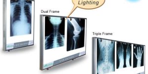 LED X Ray Film Viewer