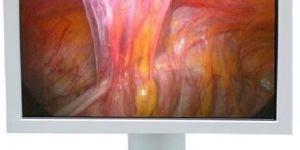 24 Surgical Grade LCD Display