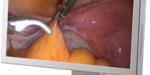 Surgical Grade LCD Display