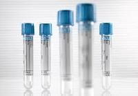 Sodium Citrate Tubes