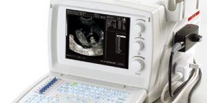 Digital Ultrasound System