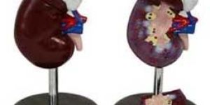 KK-051 Human kidney model