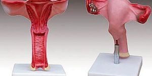 KK -086 Magnified uterus model