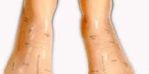 Kk -104 Foot Acupuncture Model 17cm