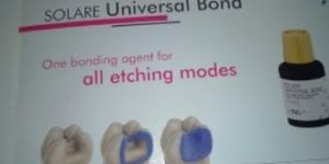 Tooth Colored Filling (Composite)