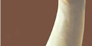 Latex Gynecological Gloves for Gynecological and Obstetrical Surgery