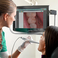 Intra Oral Camera