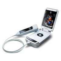 Portable Ultrasound Machine