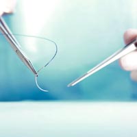 Medical Sutures