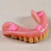 Denture Adhesive