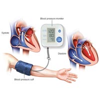 Hypertension Treatment