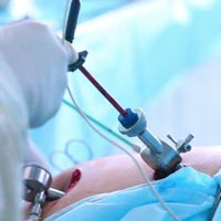 Minimal Access Surgery