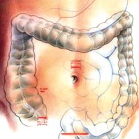 Colorectal Surgery