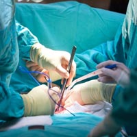 Organ Transplantation