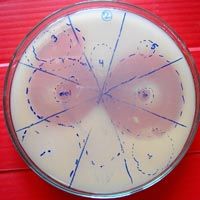 Phosphate Solubilizing Bacteria