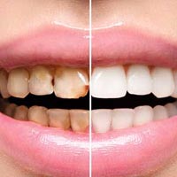 Mouth Rehabilitation Service