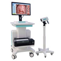 Digital Colposcopes