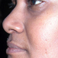 Anti Aging Treatment