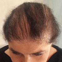Hair Building Fibres